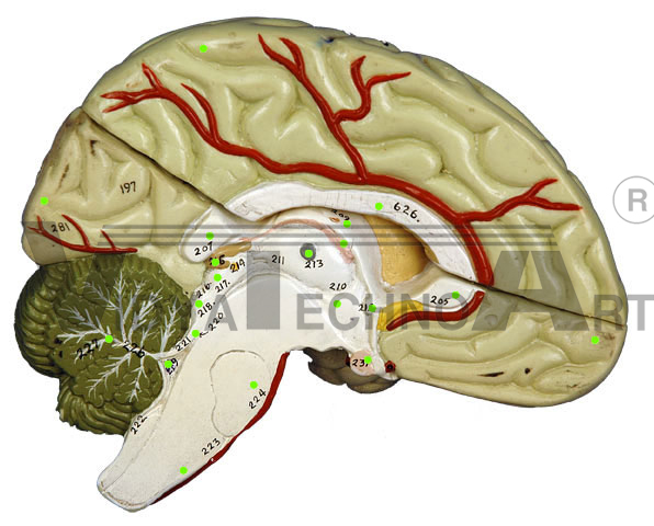 Torso Brain